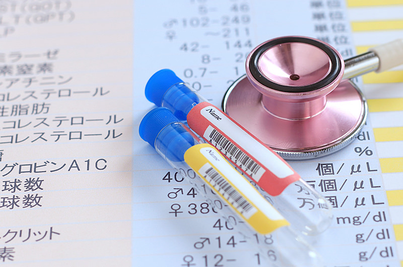 腫瘍マーカー検査・臓器別腫瘍マーカー検査を実施